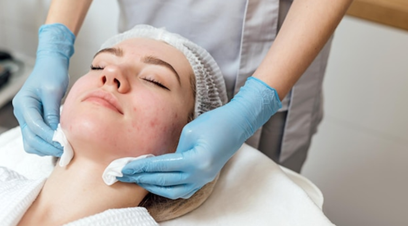 Esthetician Tools for Acne Treatment: A Comprehensive Guide